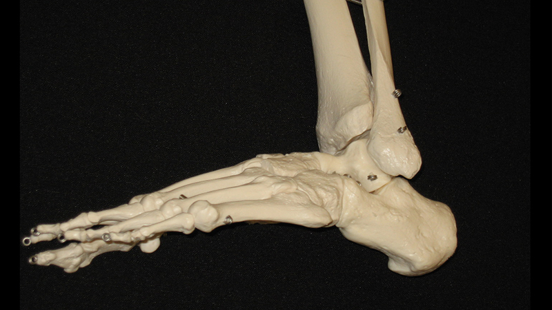ogam-skellet-lisfranc-seite