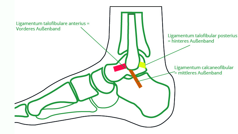 Sprunggelenkfraktur Ogam Orthopadie
